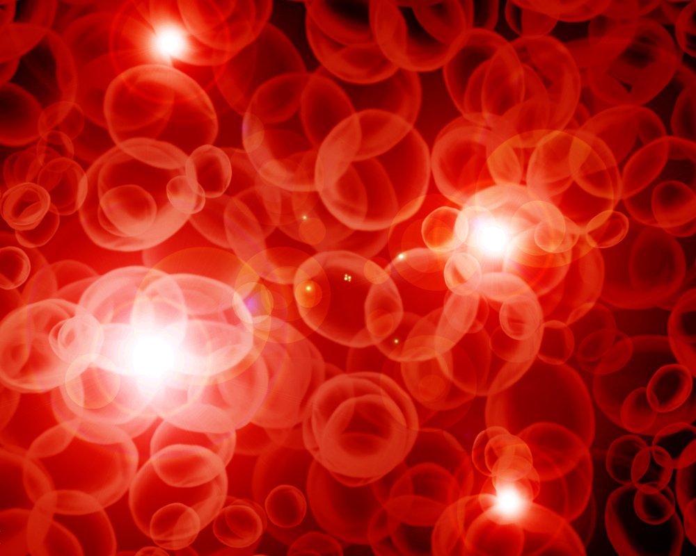 Polyglobulie primitive (maladie de Vaquez) et thrombocytémie ...